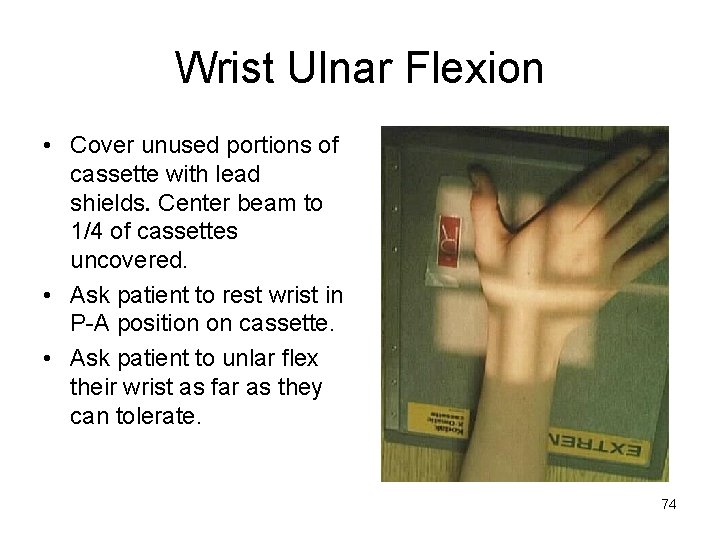 Wrist Ulnar Flexion • Cover unused portions of cassette with lead shields. Center beam