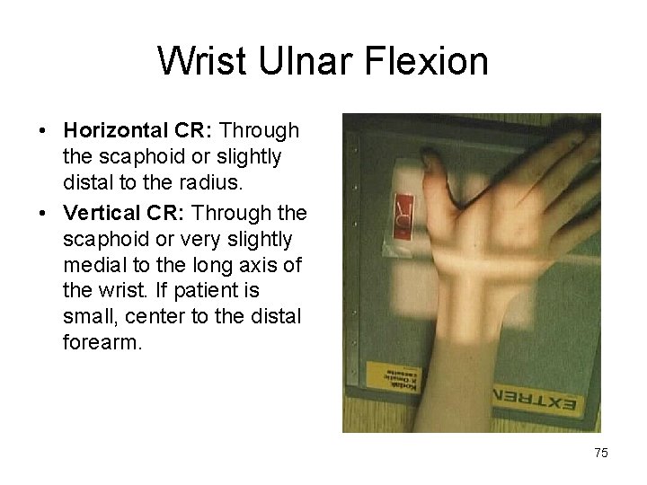Wrist Ulnar Flexion • Horizontal CR: Through the scaphoid or slightly distal to the