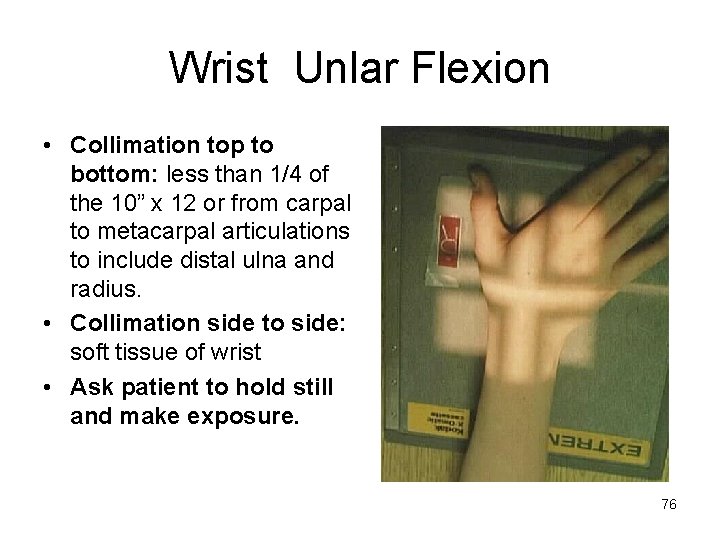 Wrist Unlar Flexion • Collimation top to bottom: less than 1/4 of the 10”