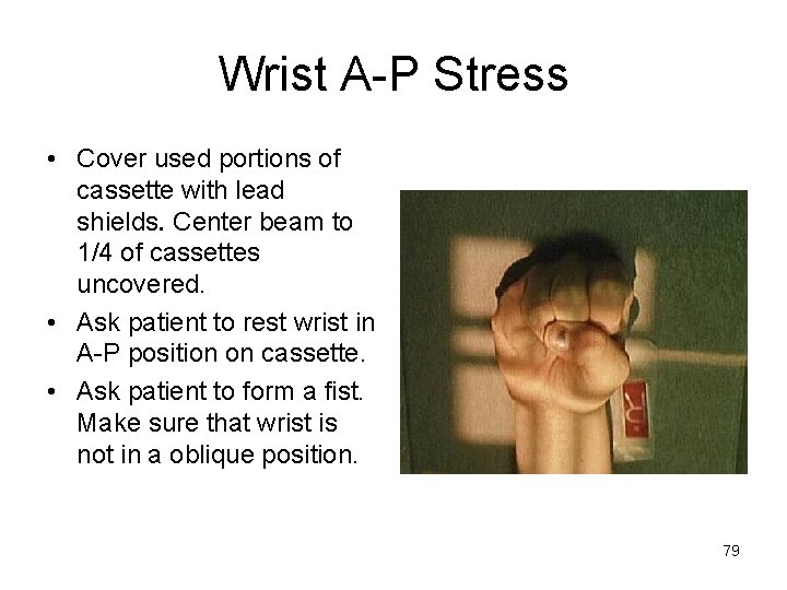 Wrist A-P Stress • Cover used portions of cassette with lead shields. Center beam