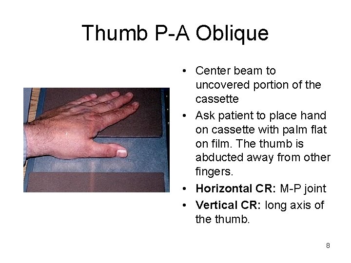 Thumb P-A Oblique • Center beam to uncovered portion of the cassette • Ask