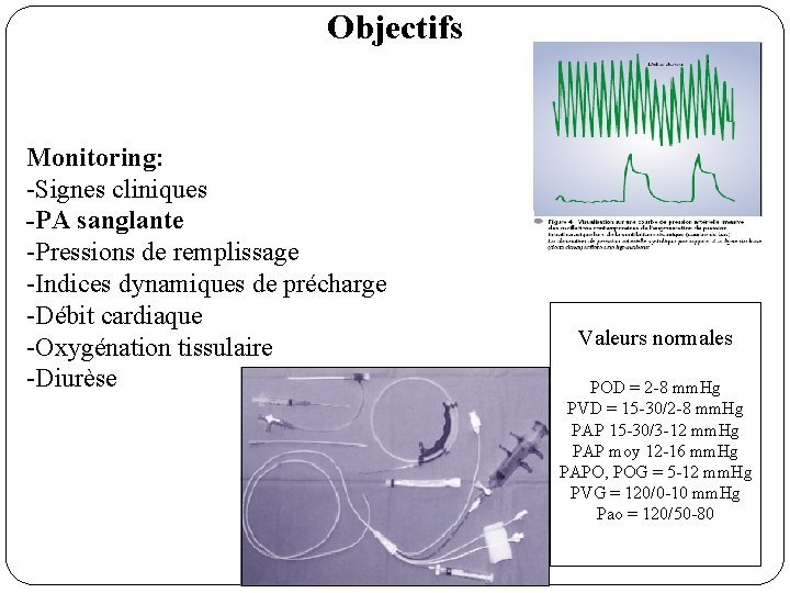 Objectifs Monitoring: -Signes cliniques -PA sanglante -Pressions de remplissage -Indices dynamiques de précharge -Débit