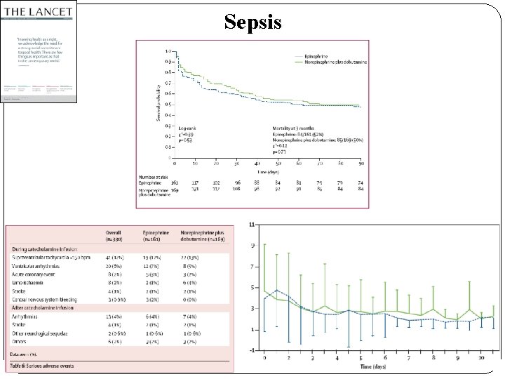 Sepsis 