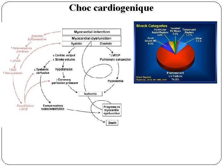 Choc cardiogenique 