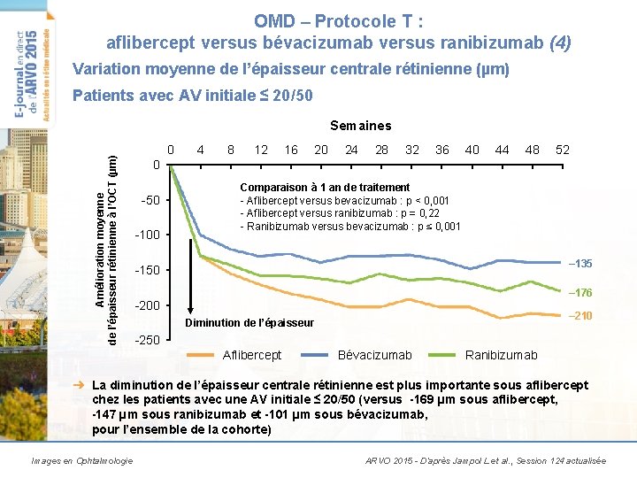 OMD – Protocole T : aflibercept versus bévacizumab versus ranibizumab (4) Variation moyenne de