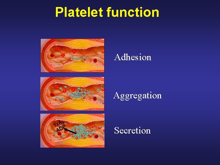 Platelet function Adhesion Aggregation A 2 Tx P AD Secretion 