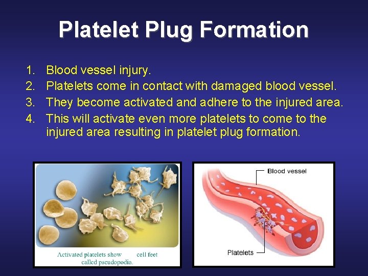 Platelet Plug Formation 1. 2. 3. 4. Blood vessel injury. Platelets come in contact