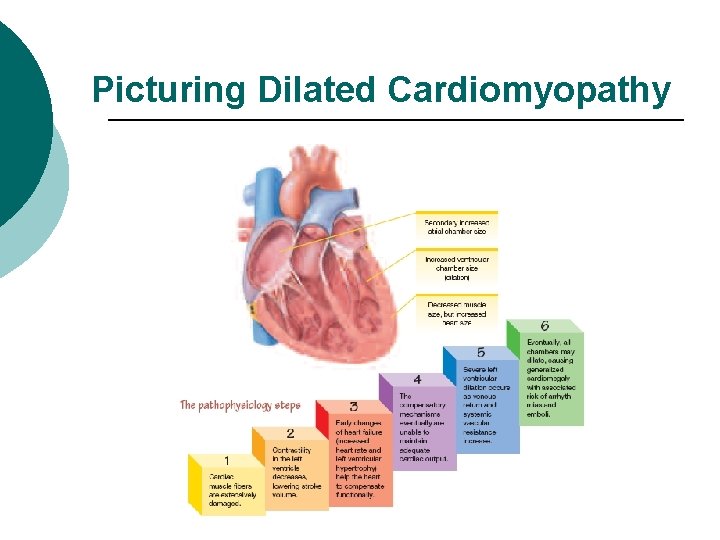 Picturing Dilated Cardiomyopathy 