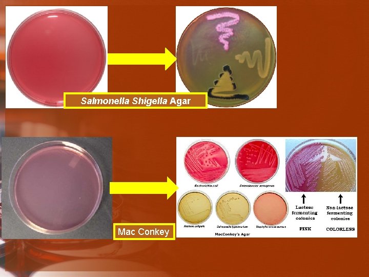 Salmonella Shigella Agar Mac Conkey 