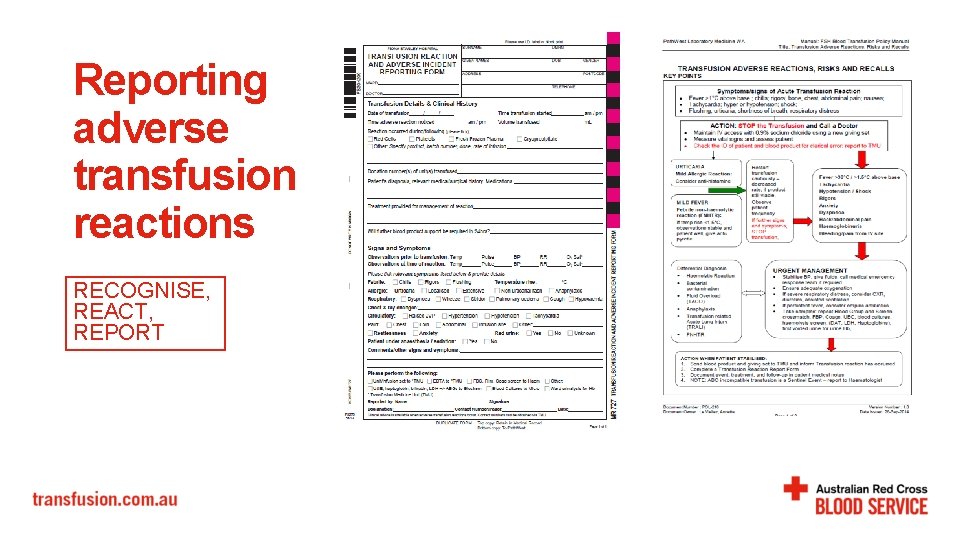 Reporting adverse transfusion reactions RECOGNISE, REACT, REPORT Reporting adverse transfusion reactions RECOGNISE, REACT, REPORT