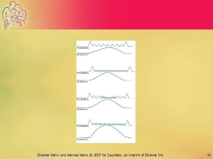 Elsevier items and derived items © 2007 by Saunders, an imprint of Elsevier Inc.