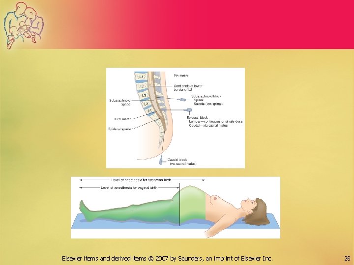 Elsevier items and derived items © 2007 by Saunders, an imprint of Elsevier Inc.