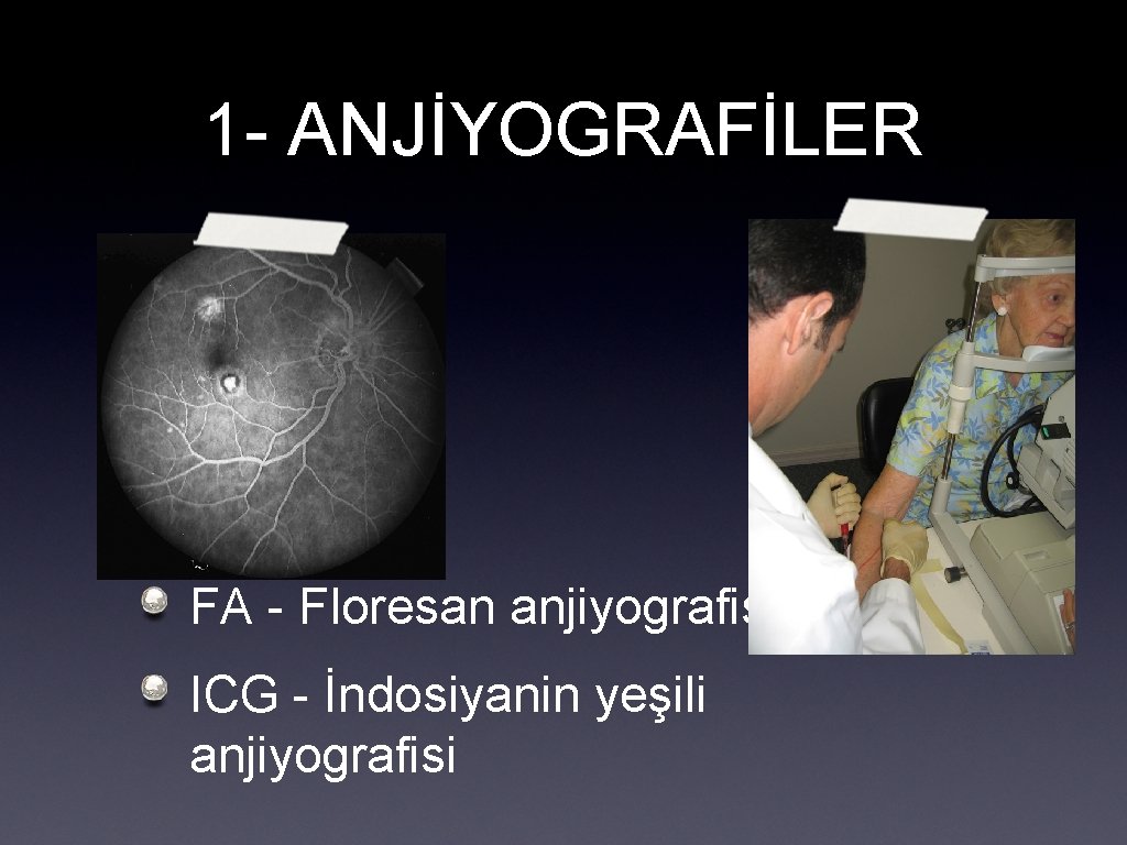 1 - ANJİYOGRAFİLER FA - Floresan anjiyografisi ICG - İndosiyanin yeşili anjiyografisi 