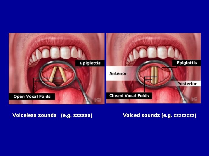 Voiceless sounds (e. g. ssssss) Voiced sounds (e. g. zzzz) 