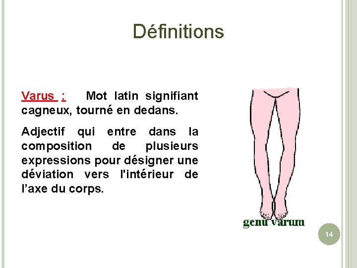 Définitions Varus : Mot latin signifiant cagneux, tourné en dedans. Adjectif qui entre dans