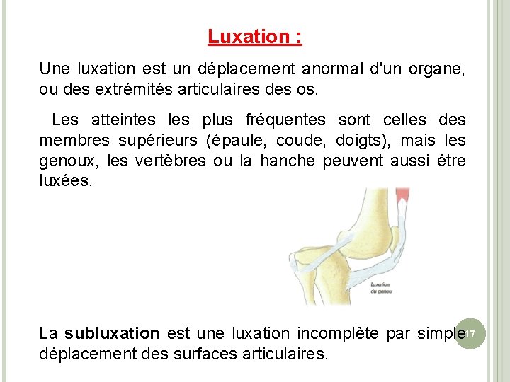 Luxation : Une luxation est un déplacement anormal d'un organe, ou des extrémités articulaires