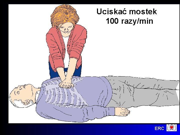  Uciskać mostek 100 razy/min ERC 