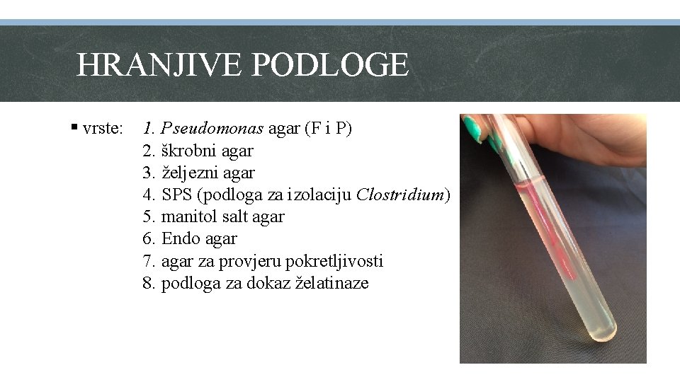 HRANJIVE PODLOGE § vrste: 1. Pseudomonas agar (F i P) 2. škrobni agar 3.