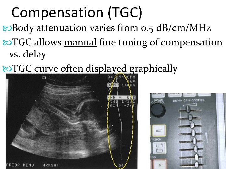 Compensation (TGC) Body attenuation varies from 0. 5 d. B/cm/MHz TGC allows manual fine