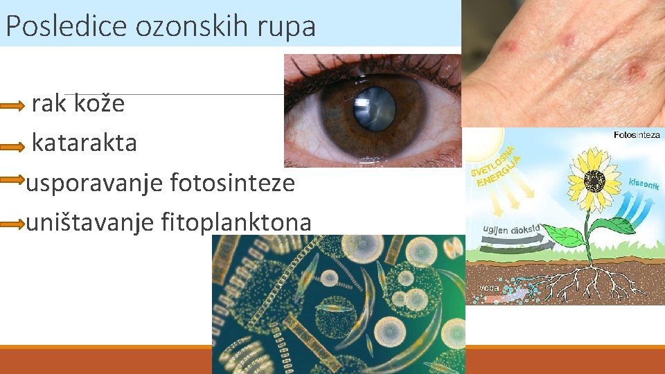 Posledice ozonskih rupa rak kože katarakta usporavanje fotosinteze uništavanje fitoplanktona 
