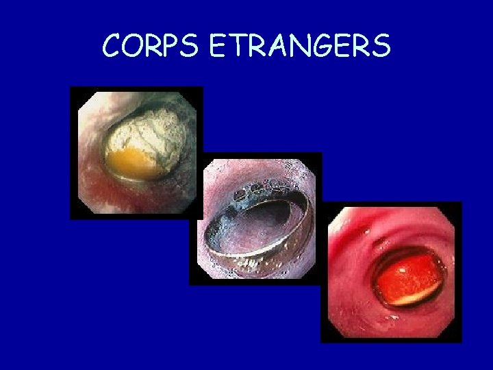 CORPS ETRANGERS 