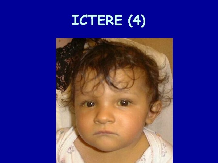 ICTERE (4) 