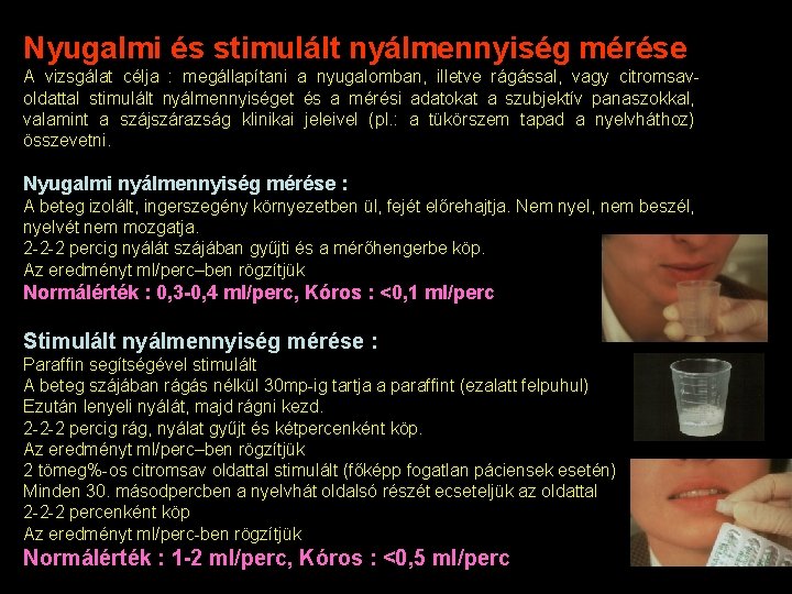 Nyugalmi és stimulált nyálmennyiség mérése A vizsgálat célja : megállapítani a nyugalomban, illetve rágással,