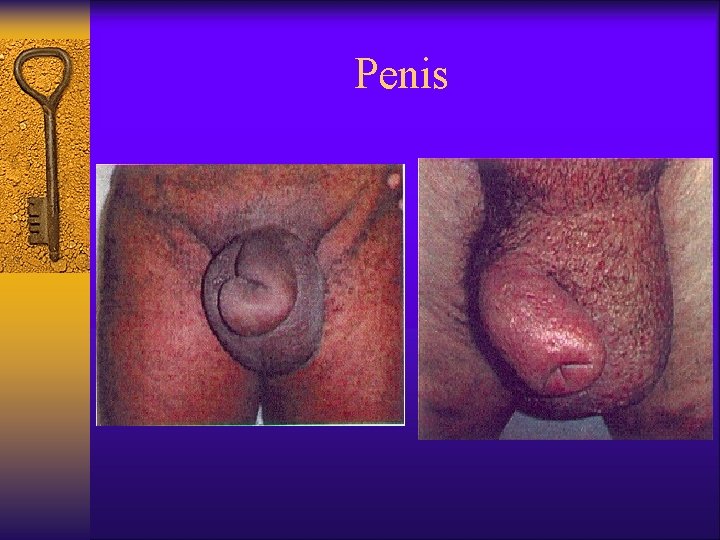 Penis 