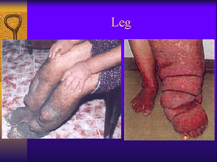 Leg 