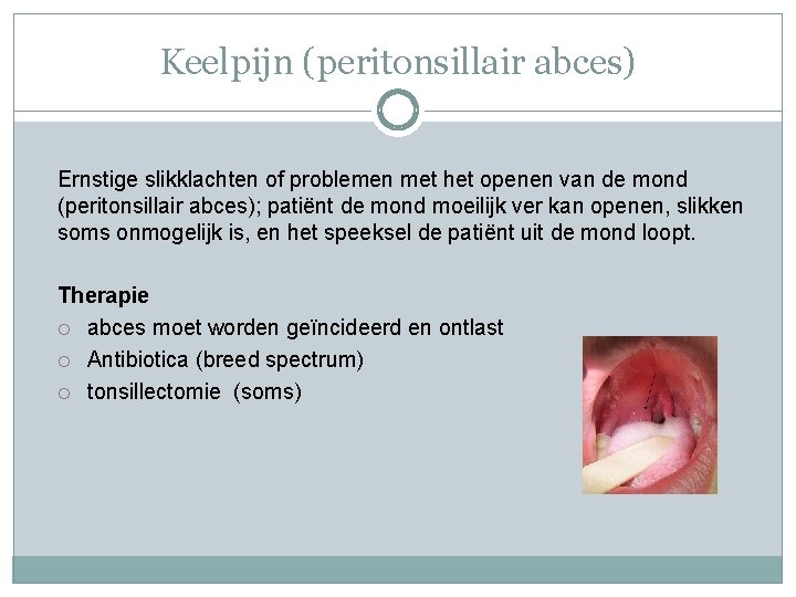 Keelpijn (peritonsillair abces) Ernstige slikklachten of problemen met het openen van de mond (peritonsillair