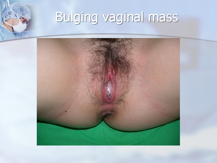 Bulging vaginal mass 