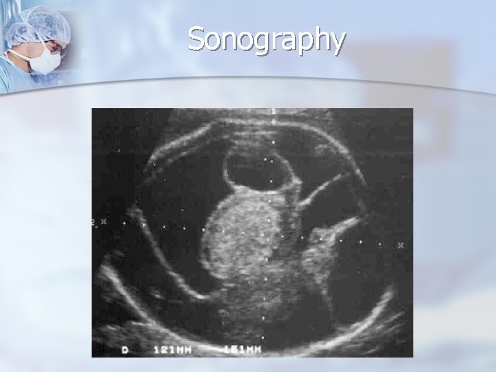 Sonography 
