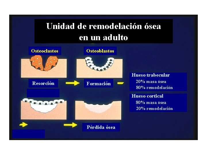 Unidad de remodelación ósea en un adulto Osteoclastos Osteoblastos Hueso trabecular Resorción Formación 20%
