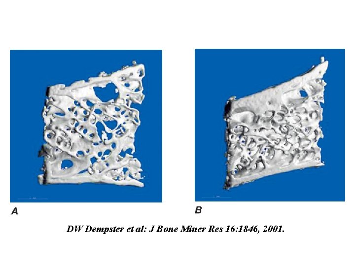 DW Dempster et al: J Bone Miner Res 16: 1846, 2001. 