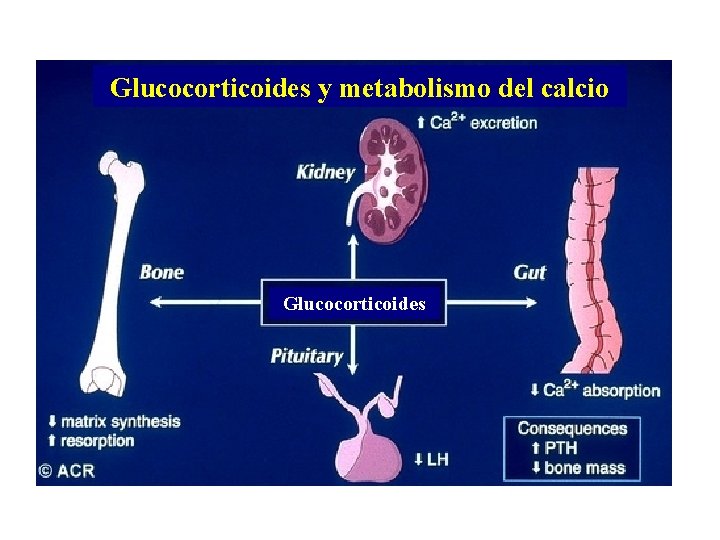 Glucocorticoides y metabolismo del calcio Glucocorticoides 