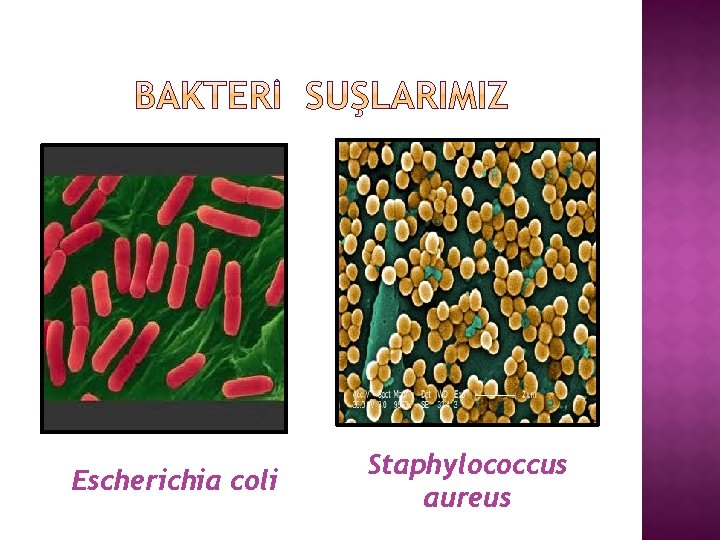 Escherichia coli Staphylococcus aureus 