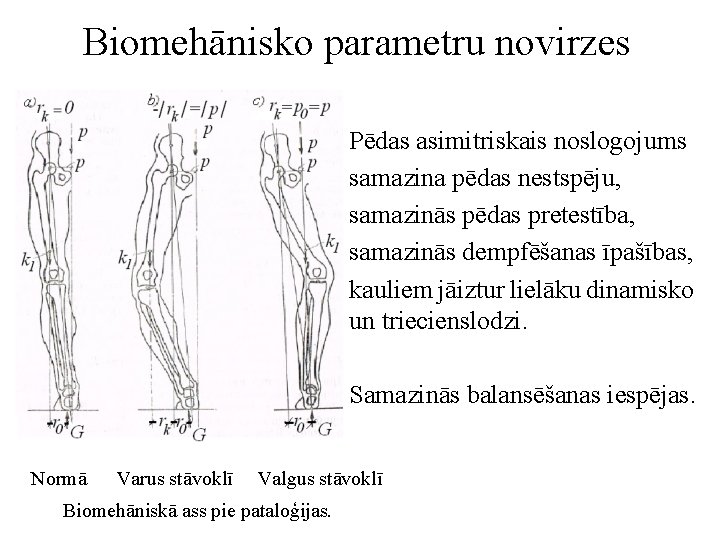 Biomehānisko parametru novirzes Pēdas asimitriskais noslogojums samazina pēdas nestspēju, samazinās pēdas pretestība, samazinās dempfēšanas