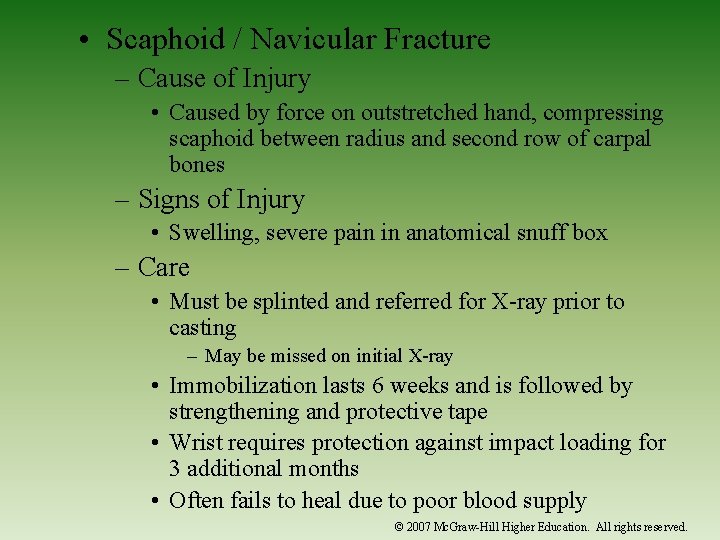  • Scaphoid / Navicular Fracture – Cause of Injury • Caused by force