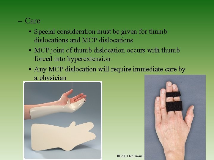 – Care • Special consideration must be given for thumb dislocations and MCP dislocations