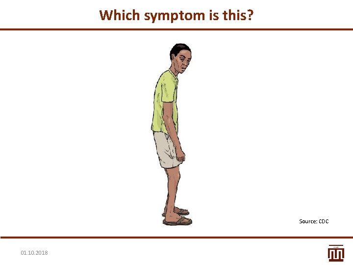 Which symptom is this? Source: CDC 01. 10. 2018 
