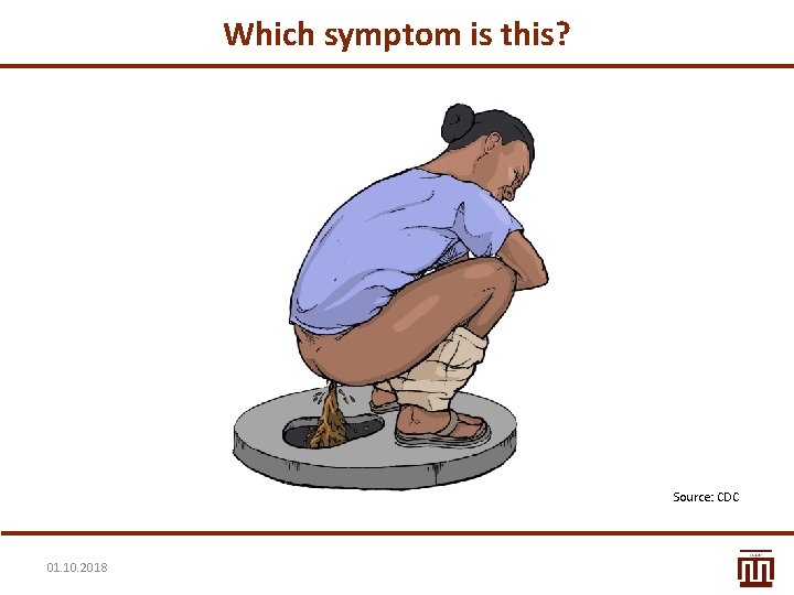 Which symptom is this? Source: CDC 01. 10. 2018 