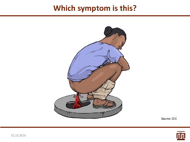 Which symptom is this? Source: CDC 01. 10. 2018 