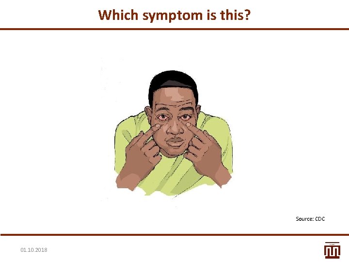 Which symptom is this? Source: CDC 01. 10. 2018 