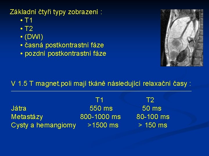 Základní čtyři typy zobrazení : • T 1 • T 2 • (DWI) •