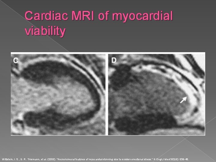 Cardiac MRI of myocardial viability Wittstein, I. S. , D. R. Thiemann, et al.