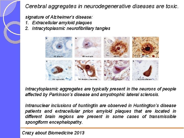 Cerebral aggregates in neurodegenerative diseases are toxic. signature of Alzheimer’s disease: 1. Extracellular amyloid