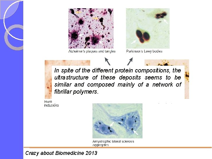 In spite of the different protein compositions, the ultrastructure of these deposits seems to