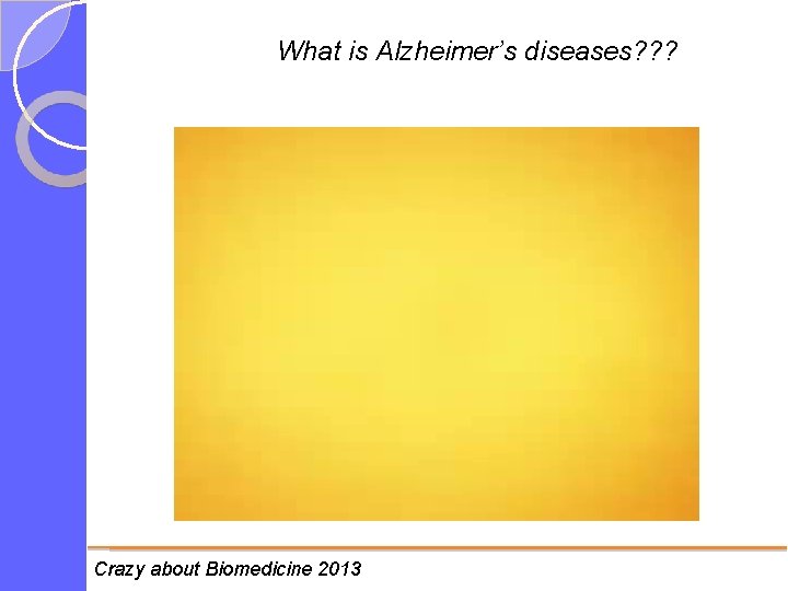 What is Alzheimer’s diseases? ? ? Crazy about Biomedicine 2013 