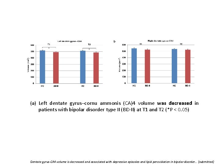 (a) Left dentate gyrus–cornu ammonis (CA)4 volume was decreased in patients with bipolar disorder