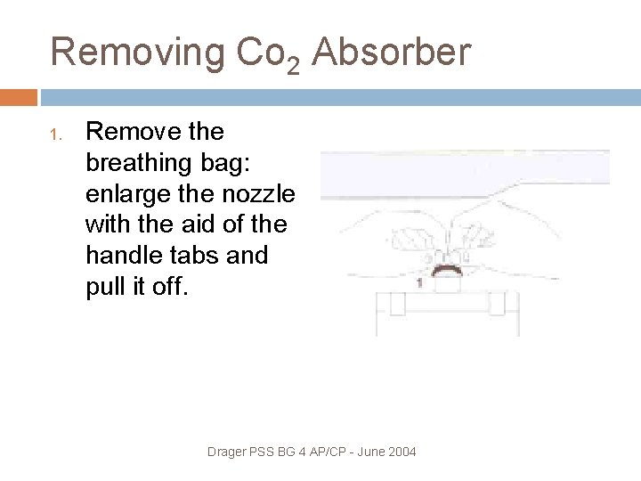Removing Co 2 Absorber 1. Remove the breathing bag: enlarge the nozzle with the